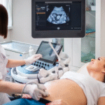 fetal Doppler scan,