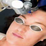 Laser Skin Treatments Indianapolis